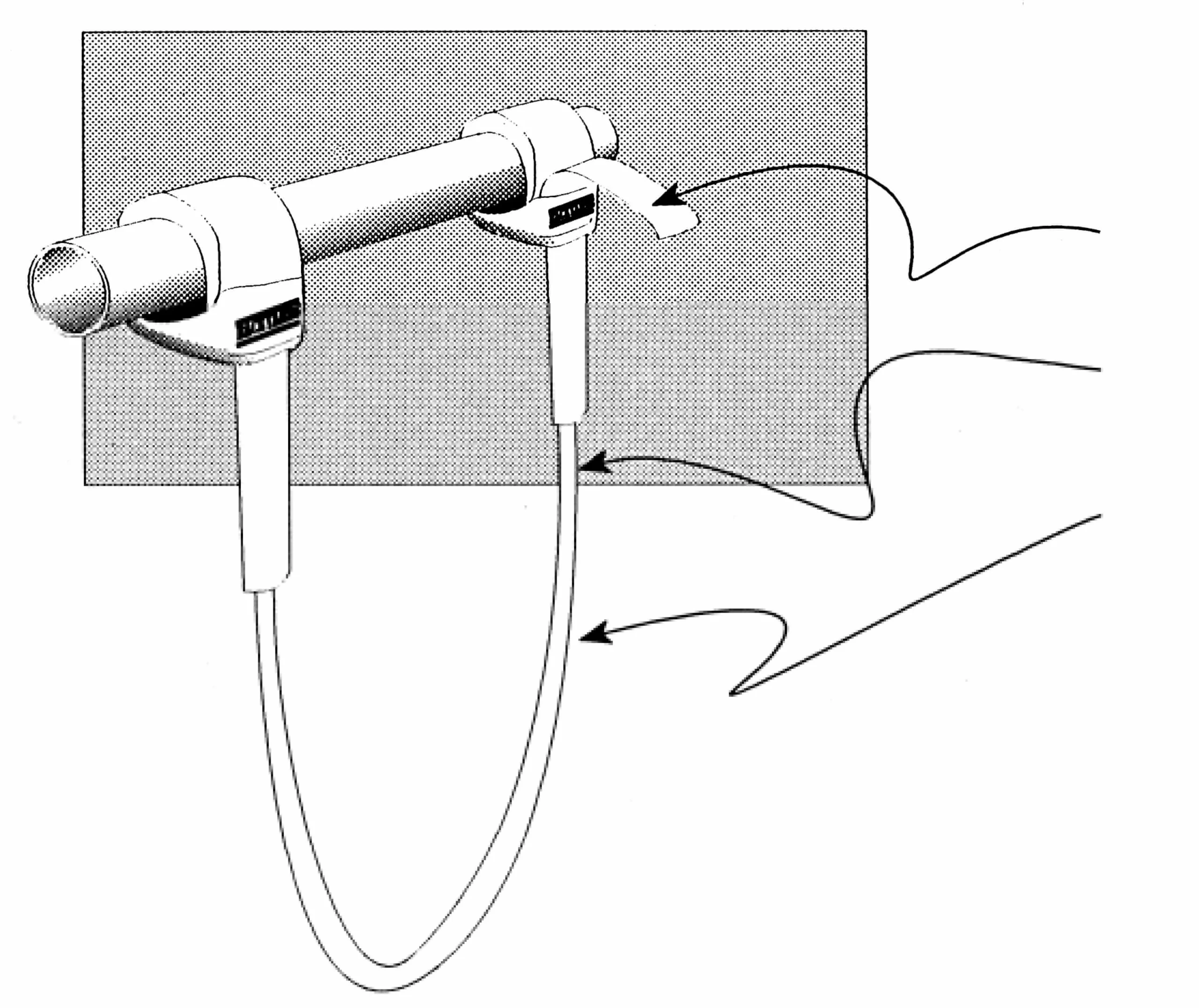 Ascan Trapeztampen Powerset 4 Ascan Trapeztampen Powerset – Bild 2